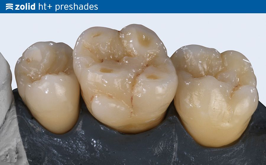 Ceramill Zolid