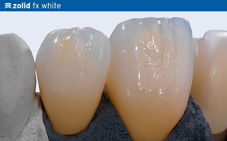 Ceramill Zolid fx Multi